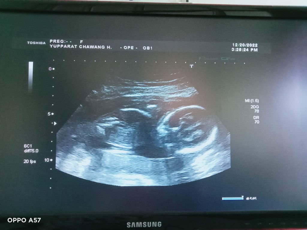 ศุภาวรรณ งามประดิษฐ์ profile icon