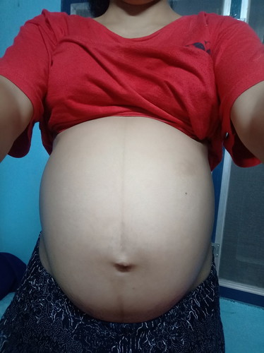 35+1