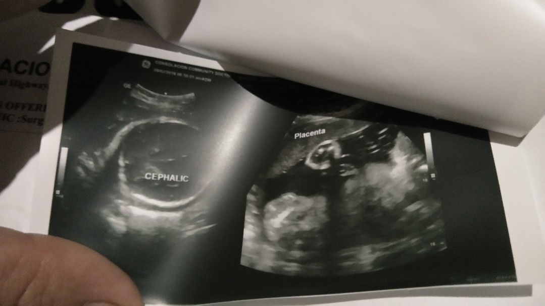 need name ng baby girl