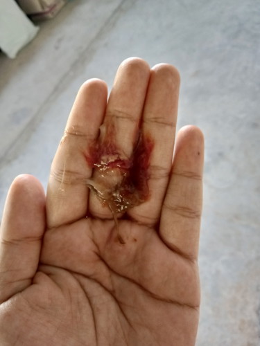 ใช่มูดเลือดไหมค่ะ