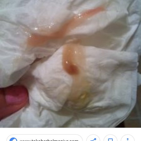 Keluar Lendir + Darah Sedikit