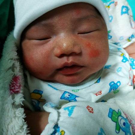 คลอดแล้วค่ะ