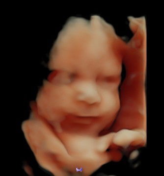 SYSUR Fams profile icon