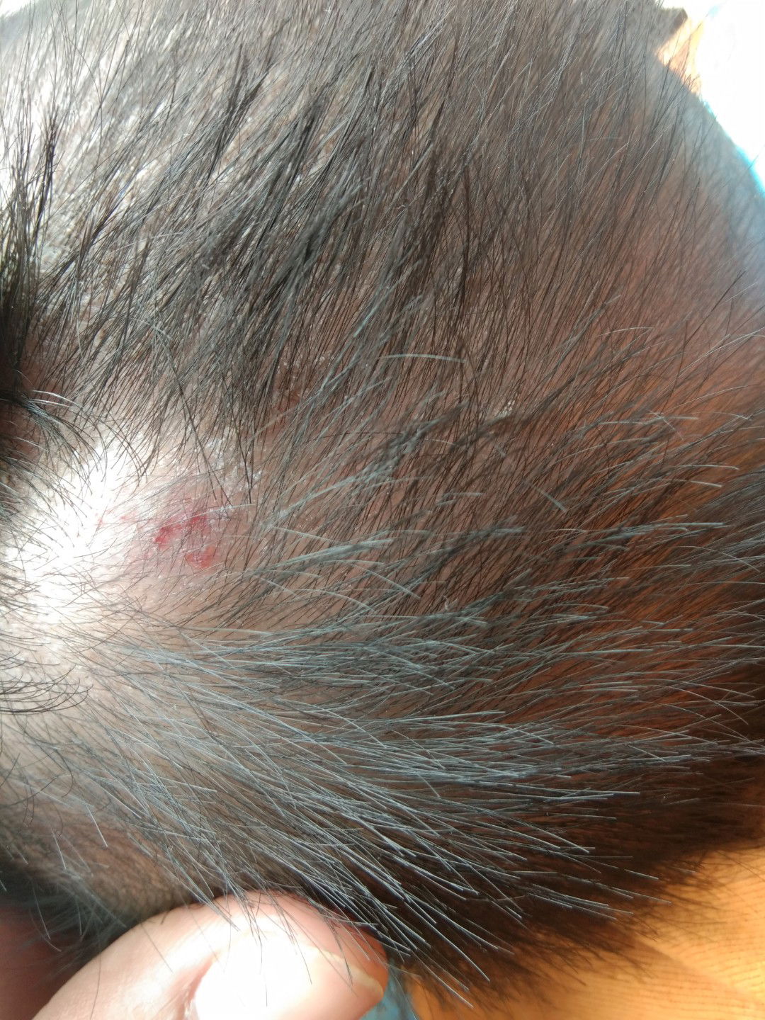 minta masukan/nasihat