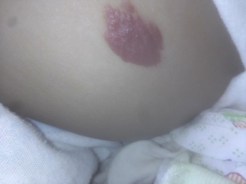 ถามหน่อยค่ะมีลูกบ้านไหนเป็นแบบนี้บ้างค่ะ