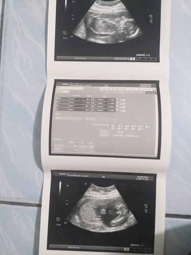ผิดคาดอยากได้ลูกสาว