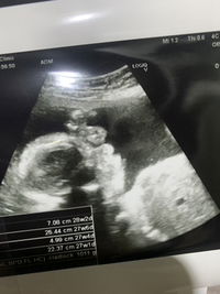 Kodchapun Aobun profile icon