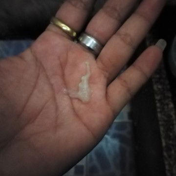 แบบนี้ตกขาวรึมูกคะ​