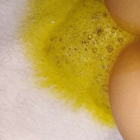 worried sa popo ni baby.,