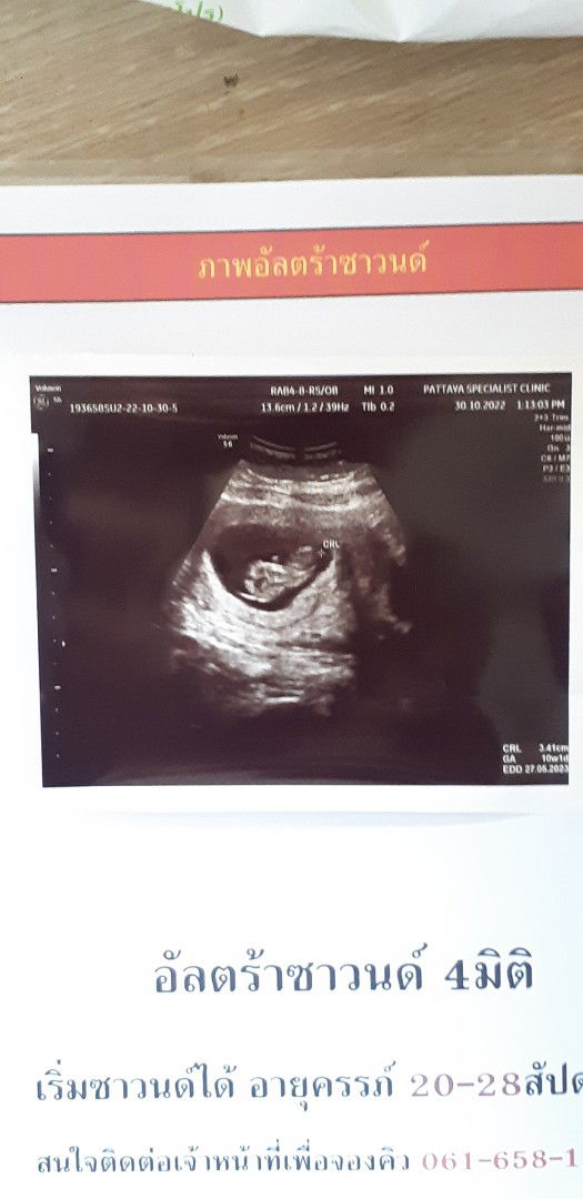 Achiraya Orain profile icon