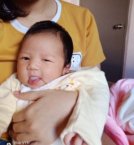 ฝ้าในปากเด็กทารก
