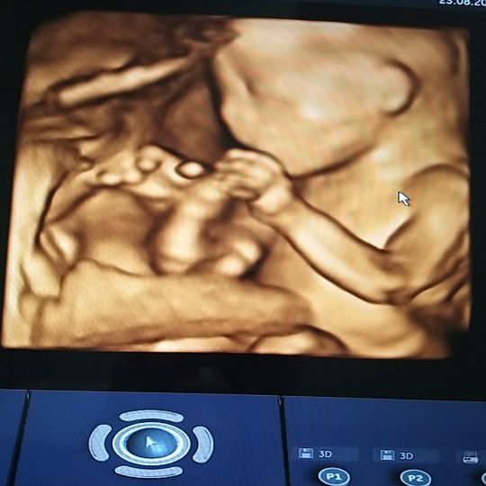 เตรียมตัวเที่ยว