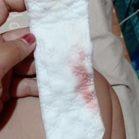 Bleeding 31 weeks