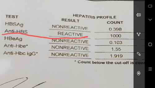 Anti-hbs reactive means....