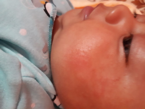 pipi kena air susu
