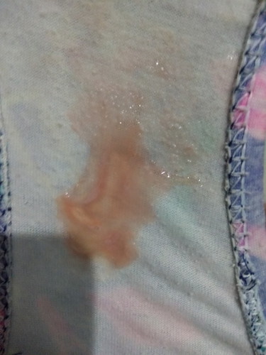 Mucus plug?