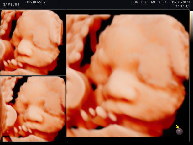 Anggi Putri Ana profile icon