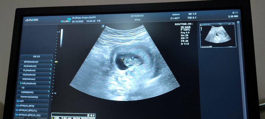 Elmy Elmy profile icon