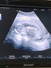 อุนแม่มือใหม่ profile icon