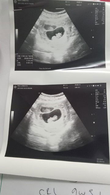 Kurniasari Rizki profile icon