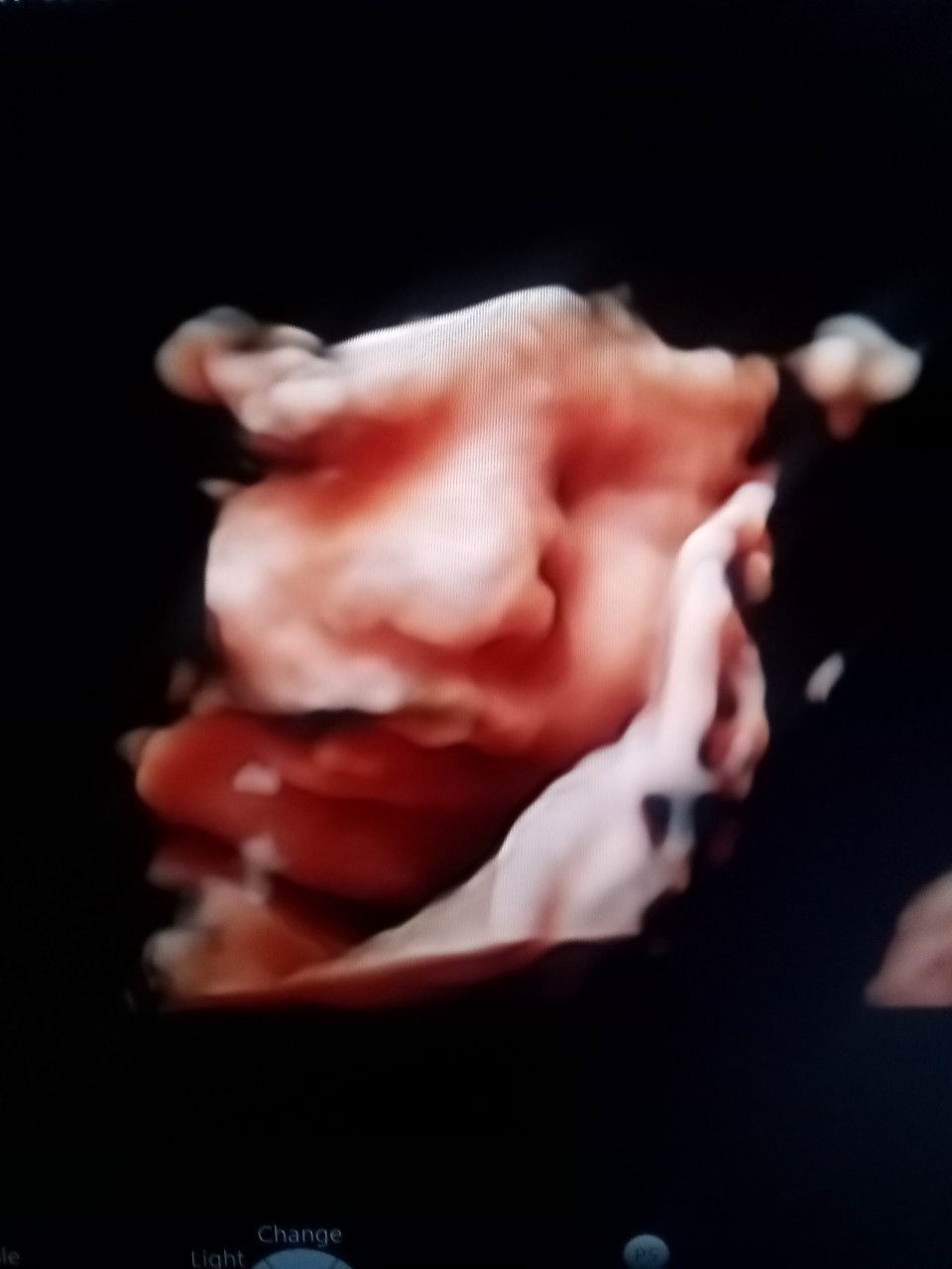 Leamae Surigao Proja profile icon