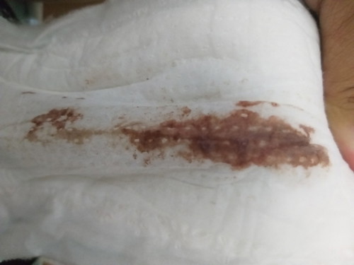 brown or blood?