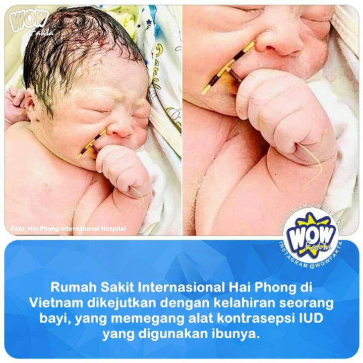 KELUHAN KB IUD