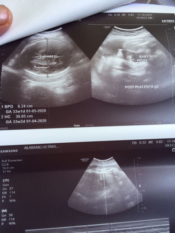 1st time soon to be Mommy ?