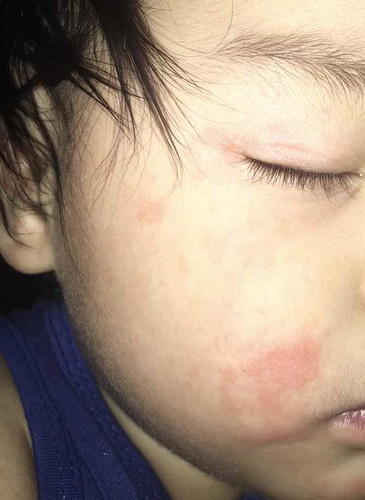 natubo sa mukha ni baby