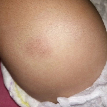 imunisasi dpt polio 2