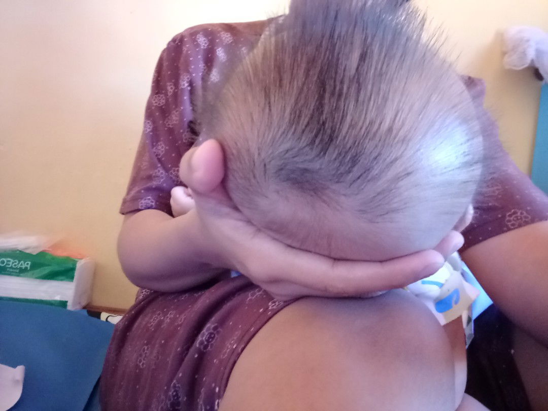 kepala peyang usia 3bln