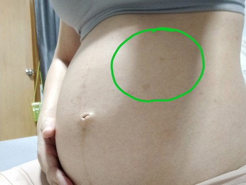 รู้สึกร้อนๆ