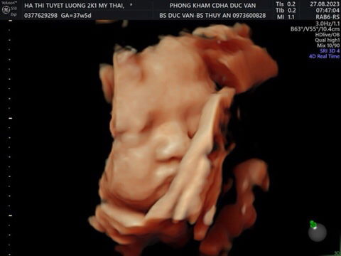 Tuyết Lương profile icon