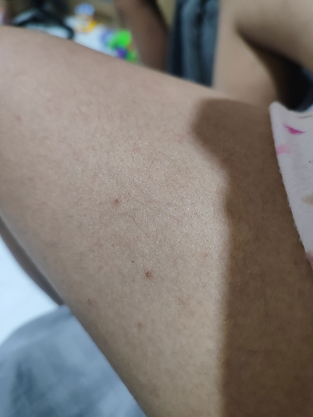 Pangangati ng Ibat ibang parte ng katawan