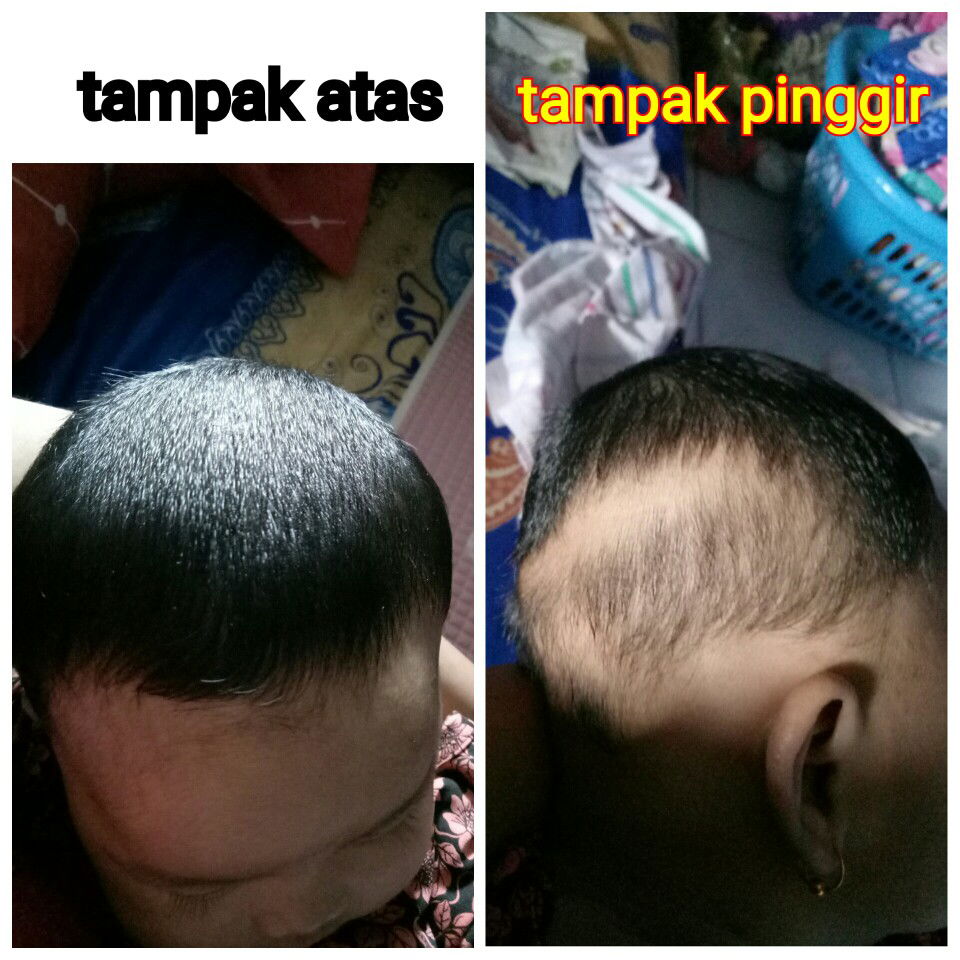 TUMBUH TIDAK RATA