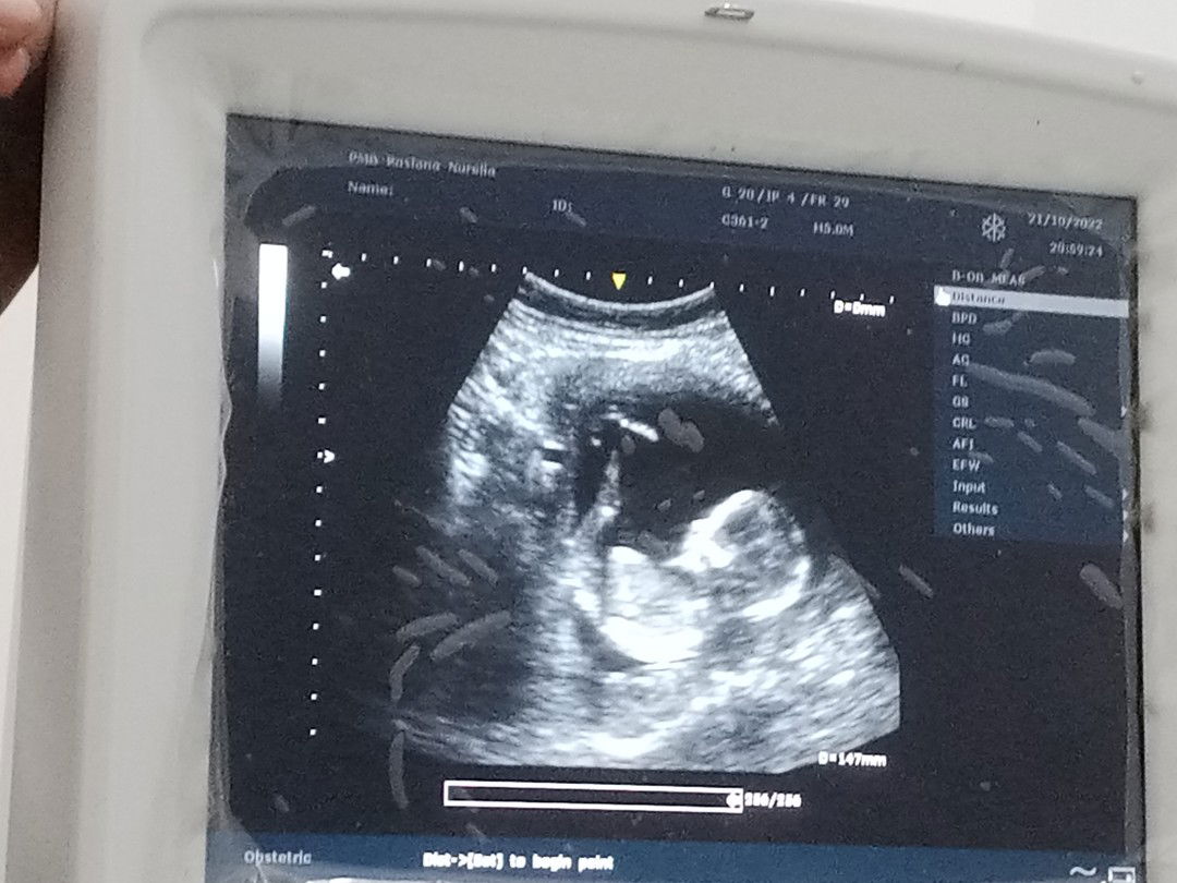 intanpermatasari profile icon