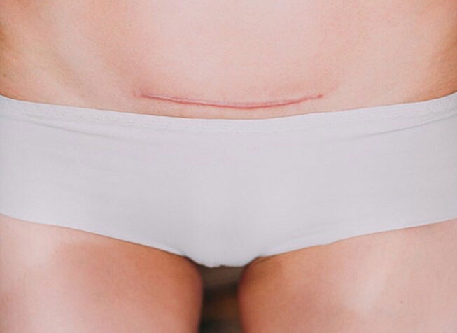 หลังคลอด‼️