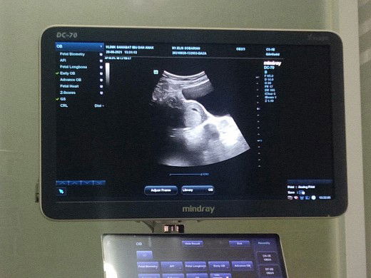 Ellis Sobariah profile icon