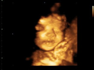 Baby girl name suggestions please?