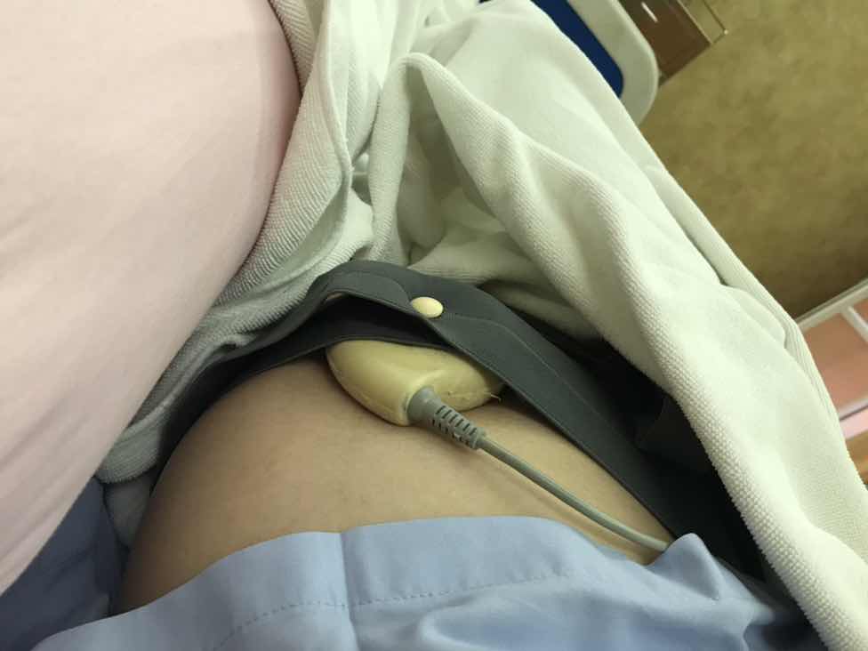 มีคุณแม่คนไหนคลอดก่อนกำหนด(ต่ำกว่า34วีคไหมคะ)