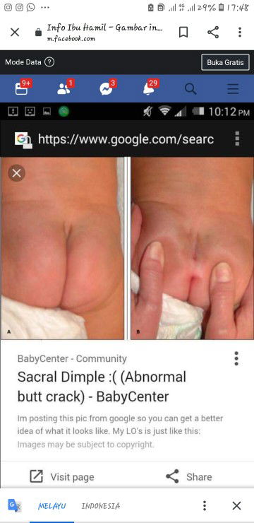 mohon di jawab ya bun klo ada yg tau?