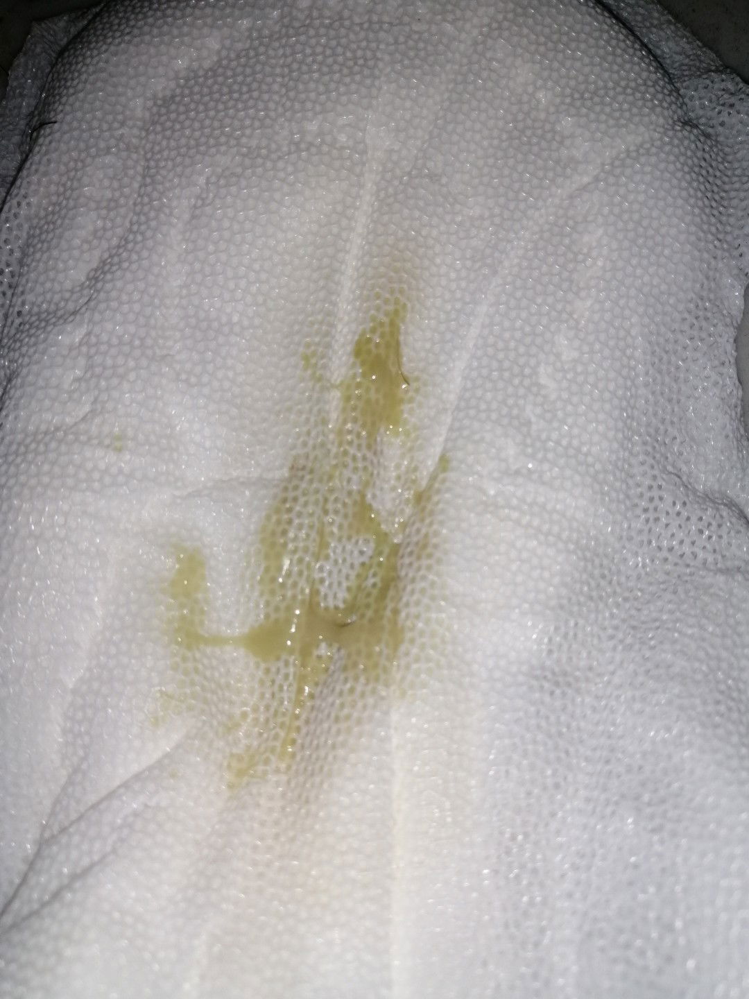 ilang weeks na ako nagtataka dito?