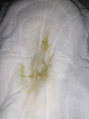 ilang weeks na ako nagtataka dito?