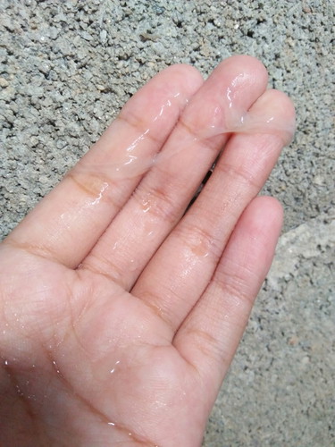 แม่ๆค่ะ. แบบนี้ใช่มูกหรือป่าวค่ะ