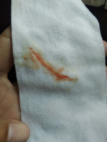 38สัปดาห์4วัน