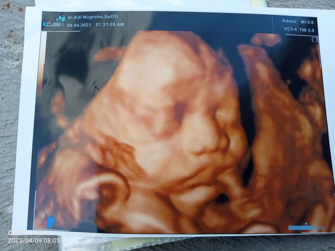 zakiatun nisa profile icon