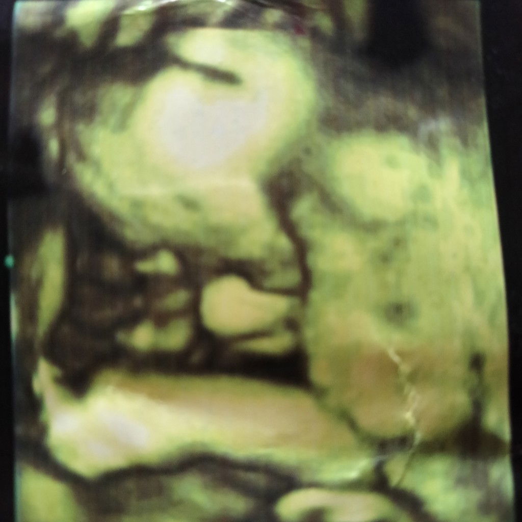 Nông Thị Thúy Hòa profile icon