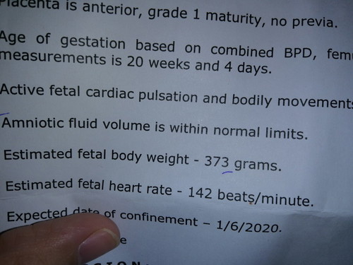 Fetal weight