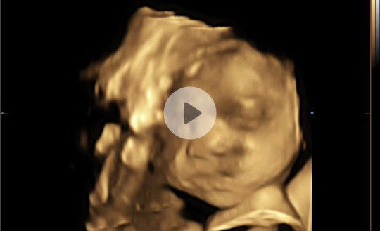 28weeks 4D ultrasound