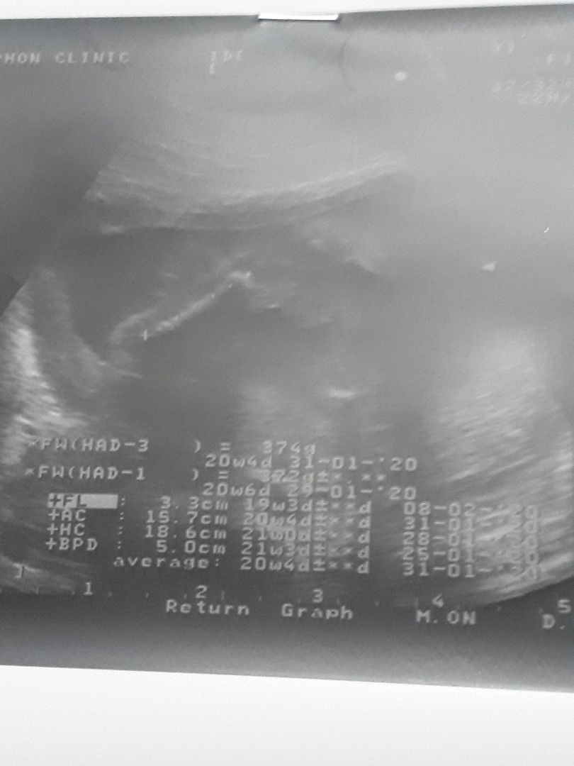 ผู้ชายหรือผู้หญิงค่ะแม่ๆๆช่วยดูให้หน่อยค่ะ